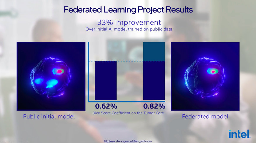 Intel and Penn Medicine Announce Results of Largest Medical Federated Learning Study